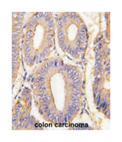 PAK1 Rabbit anti-Human, Polyclonal Antibody, Abnova 400 &mu;L | Buy Online | Abnova Corporation | Fisher Scientific
