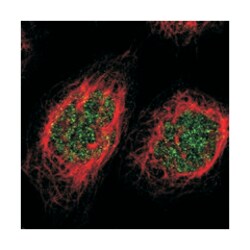 ZNF629, Rabbit, Polyclonal Antibody, Abnova 100 &mu;L | Buy Online | Abnova Corporation | Fisher Scientific