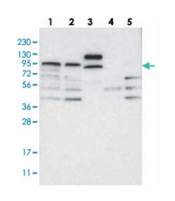 ABCG8 Rabbit anti-Human, Polyclonal Antibody, Abnova 100&mu;L; Unlabeled:Antibodies,