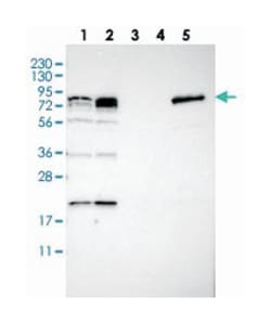 PNPLA8 Rabbit anti-Human, Polyclonal Antibody, Abnova 100 &mu;L | Buy Online | Abnova Corporation | Fisher Scientific