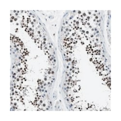 LRWD1 Rabbit anti-Human, Polyclonal Antibody, Abnova 100 &mu;L | Buy Online | Abnova Corporation | Fisher Scientific