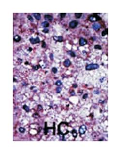 PFKM Rabbit anti-Human, Polyclonal Antibody, Abnova 400&mu;L; Unlabeled:Antibodies,