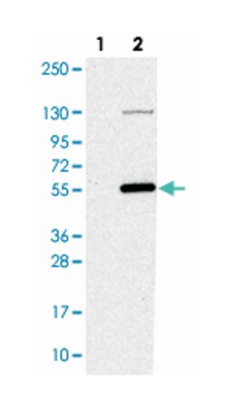 NAT16, Rabbit, Polyclonal Antibody, Abnova 100 &mu;L | Buy Online | Abnova Corporation | Fisher Scientific
