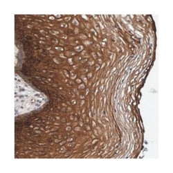 MFSD6L, Rabbit, Polyclonal Antibody, Abnova 100 &mu;L | Buy Online | Abnova | Fisher Scientific