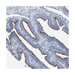 SLC28A3 Rabbit anti-Human, Polyclonal Antibody, Abnova 100&mu;L; Unlabeled:Antibodies,