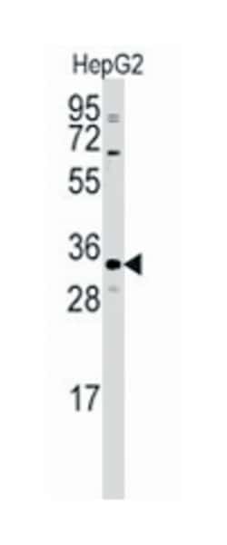 CTDSP2, Rabbit, Polyclonal Antibody, Abnova 400 &mu;L | Buy Online | Abnova Corporation | Fisher Scientific