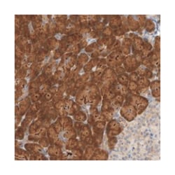 TATDN1, Rabbit, Polyclonal Antibody, Abnova 100 &mu;L | Buy Online | Abnova Corporation | Fisher Scientific