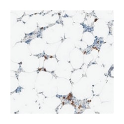 ARHGAP27, Rabbit, Polyclonal Antibody, Abnova 100 &mu;L | Buy Online | Abnova Corporation | Fisher Scientific