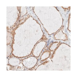 XKR4 Rabbit anti-Human, Polyclonal Antibody, Abnova 100 &mu;L | Buy Online | Abnova Corporation | Fisher Scientific