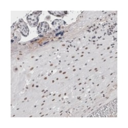 ARID4B Rabbit anti-Human, Polyclonal Antibody, Abnova 100 &mu;L | Buy Online | Abnova Corporation | Fisher Scientific