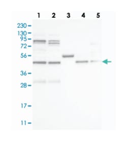 VPS37A Rabbit anti-Human, Polyclonal Antibody, Abnova 100 &mu;L | Buy Online | Abnova Corporation | Fisher Scientific