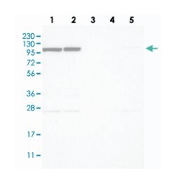DENND2A, Rabbit, Polyclonal Antibody, Abnova 100 &mu;L | Buy Online | Abnova Corporation | Fisher Scientific