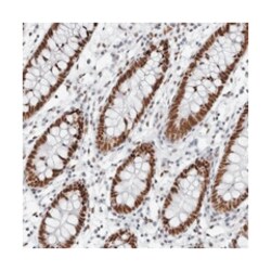 IRF2BP2 Rabbit anti-Human, Polyclonal Antibody, Abnova 100 &mu;L | Buy Online | Abnova Corporation | Fisher Scientific