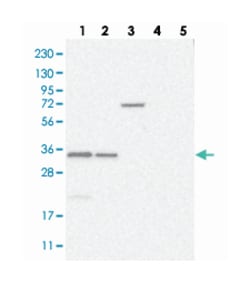 BARHL2, Rabbit, Polyclonal Antibody, Abnova 100 &mu;L | Buy Online | Abnova Corporation | Fisher Scientific