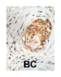 MBD3 Rabbit anti-Human, Mouse, Polyclonal Antibody, Abnova 400 &mu;L | Buy Online | Abnova Corporation | Fisher Scientific