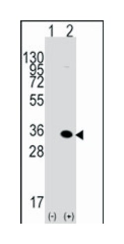 MBD3 Rabbit anti-Human, Mouse, Polyclonal Antibody, Abnova 400 &mu;L | Buy Online | Abnova Corporation | Fisher Scientific