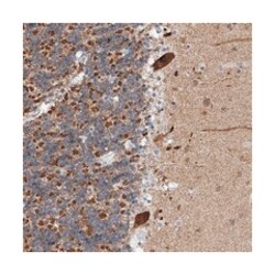 AIM1L Rabbit anti-Human, Polyclonal Antibody, Abnova 100&mu;L; Unlabeled:Antibodies,