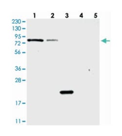 PGBD2 Rabbit anti-Human, Polyclonal Antibody, Abnova 100&mu;L; Unlabeled:Antibodies,