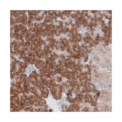 UFL1 Rabbit anti-Human, Polyclonal Antibody, Abnova 100 &mu;L | Buy Online | Abnova Corporation | Fisher Scientific