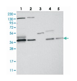 VTA1, Rabbit, Polyclonal Antibody, Abnova 100 &mu;L | Buy Online | Abnova Corporation | Fisher Scientific