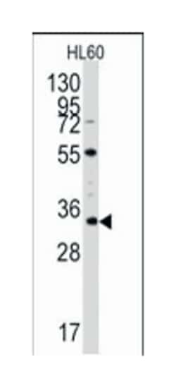 UBTD1, Rabbit, Polyclonal Antibody, Abnova 400&mu;L; Unlabeled:Antibodies,