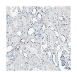 ZNF772, Rabbit, Polyclonal Antibody, Abnova 100 &mu;L | Buy Online | Abnova Corporation | Fisher Scientific