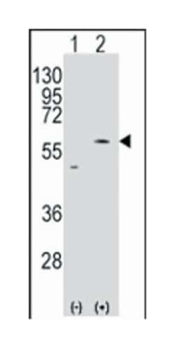 SLC29A4, Rabbit, Polyclonal Antibody, Abnova 400 &mu;L | Buy Online | Abnova Corporation | Fisher Scientific