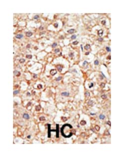 PIAS4 Rabbit anti-Human, Polyclonal Antibody, Abnova 400 &mu;L | Buy Online | Abnova Corporation | Fisher Scientific