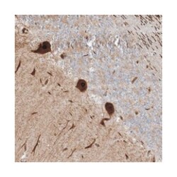 PUSL1, Rabbit, Polyclonal Antibody, Abnova 100 &mu;L | Buy Online | Abnova Corporation | Fisher Scientific