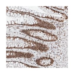 SKIV2L2, Rabbit, Polyclonal Antibody, Abnova 100&mu;L; Unlabeled:Antibodies,