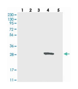 DULLARD, Rabbit, Polyclonal Antibody, Abnova 100 &mu;L | Buy Online | Abnova Corporation | Fisher Scientific