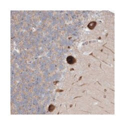 TTBK1 Rabbit anti-Human, Polyclonal Antibody, Abnova 100&mu;L; Unlabeled:Antibodies,