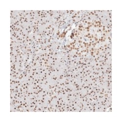 PPP4R2, Rabbit, Polyclonal Antibody, Abnova 100&mu;L; Unlabeled:Antibodies,