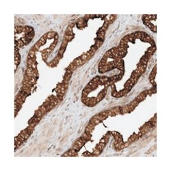 SCARF2, Rabbit, Polyclonal Antibody, Abnova 100&mu;L; Unlabeled:Antibodies,