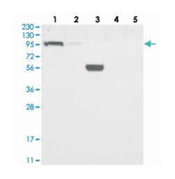 ZBBX, Rabbit, Polyclonal Antibody, Abnova 100 &mu;L | Buy Online | Abnova Corporation | Fisher Scientific