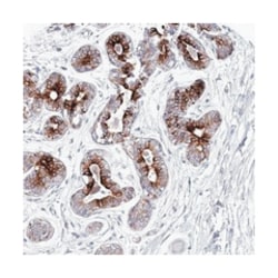 KIAA1586, Rabbit, Polyclonal Antibody, Abnova 100&mu;L; Unlabeled:Antibodies,