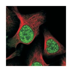 RBM15B, Rabbit, Polyclonal Antibody, Abnova 100&mu;L; Unlabeled:Antibodies,