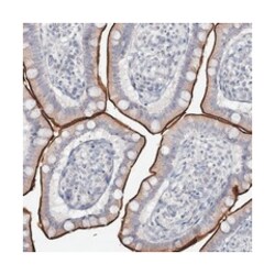 SLC9A3 Rabbit anti-Human, Polyclonal Antibody, Abnova 100 &mu;L | Buy Online | Abnova Corporation | Fisher Scientific