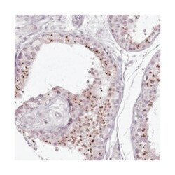 C1orf56, Rabbit, Polyclonal Antibody, Abnova 100 &mu;L | Buy Online | Abnova Corporation | Fisher Scientific