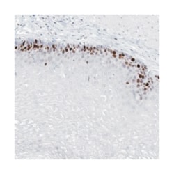 TMCO6 Rabbit anti-Human, Polyclonal Antibody, Abnova 100 &mu;L | Buy Online | Abnova Corporation | Fisher Scientific