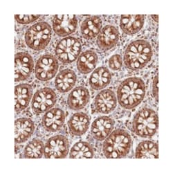 DNA2, Rabbit, Polyclonal Antibody, Abnova 100&mu;L; Unlabeled:Anticuerpos