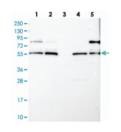 LRCH4 Rabbit anti-Human, Polyclonal Antibody, Abnova 100&mu;L; Unlabeled:Antibodies,