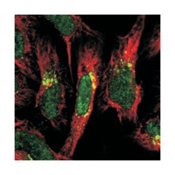 COPG, Rabbit, Polyclonal Antibody, Abnova 100&mu;L; Unlabeled:Antibodies,