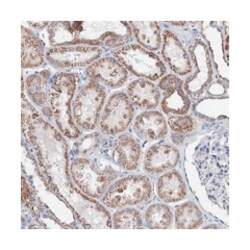 ANKRD16, Rabbit, Polyclonal Antibody, Abnova 100 &mu;L | Buy Online | Abnova Corporation | Fisher Scientific
