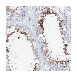 SPATA7, Rabbit, Polyclonal Antibody, Abnova 100&mu;L; Unlabeled:Antibodies,