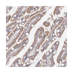 TMEM187, Rabbit, Polyclonal Antibody, Abnova 100 &mu;L | Buy Online | Abnova Corporation | Fisher Scientific