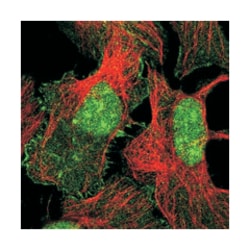 XPO6, Rabbit, Polyclonal Antibody, Abnova 100 &mu;L | Buy Online | Abnova Corporation | Fisher Scientific