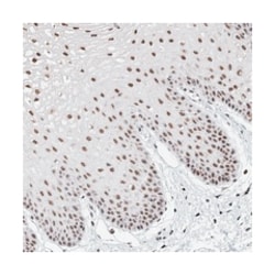 KIAA1704, Rabbit, Polyclonal Antibody, Abnova 100 &mu;L | Buy Online | Abnova Corporation | Fisher Scientific