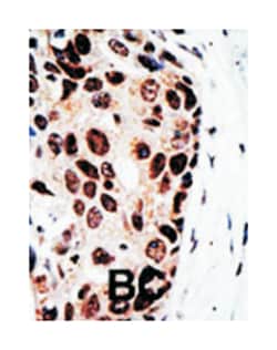 HDAC9 Rabbit anti-Human, Polyclonal Antibody, Abnova 400 &mu;L | Buy Online | Abnova Corporation | Fisher Scientific