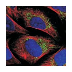 TIMM10, Rabbit, Polyclonal Antibody, Abnova 100 &mu;L | Buy Online | Abnova Corporation | Fisher Scientific